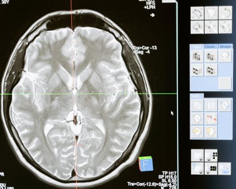technology computer head health